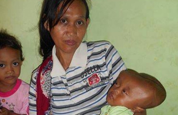 Afrizal Nur Khoir yang masih berusia 8 bulan menderita hidrosefalus didalam gendongan Suminah, ibunya.(ristika/bhirawa)